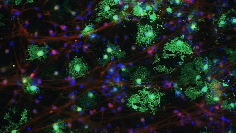 Fluorescent microscope image of control MBP-positive oligodendrocytes (in green) co-stained with alpha-synuclein (in red). It is possible to observe neurites positive for alpha-synuclein. Photo.