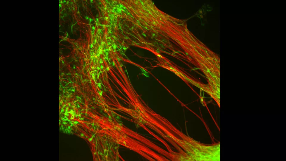 Dopamine-producing neurons that have grown in the laboratory from human embryonic stem cells. Photo. 
