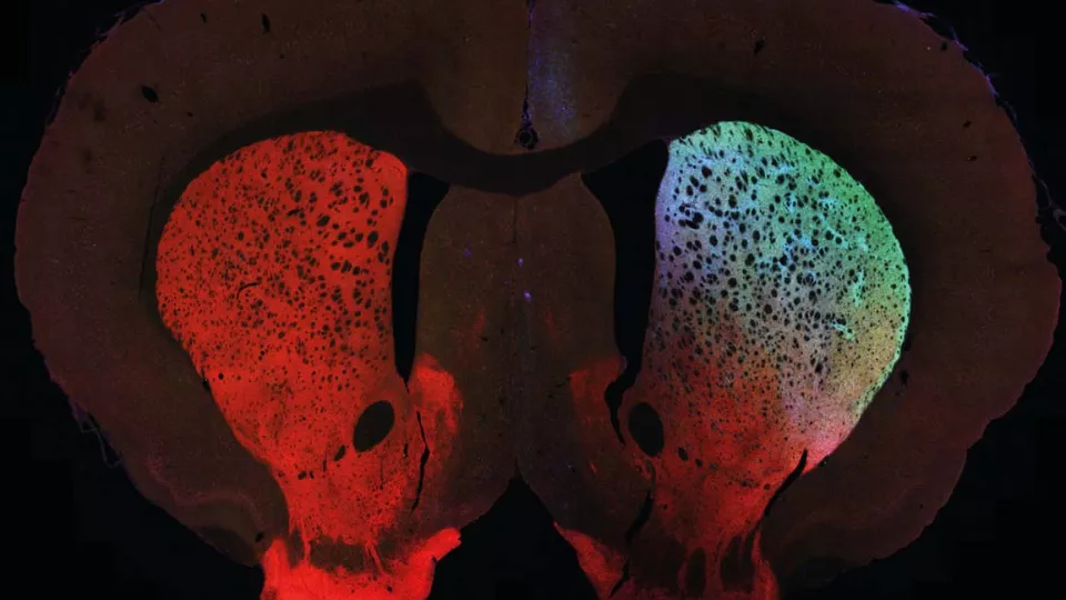 An illuminated mouse brain, shining in red, blue and green. Photo. 