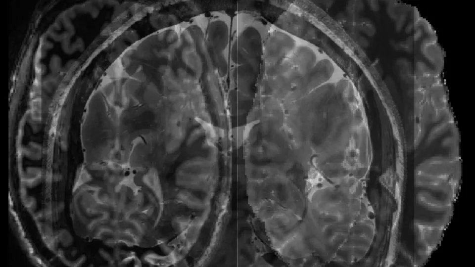 Brain scan. Photo. 