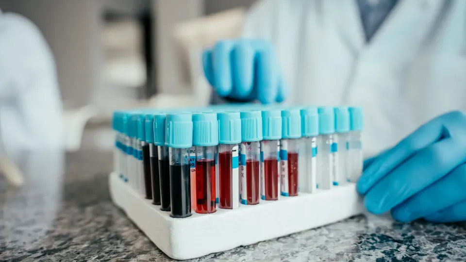 Tray of test tubes containing blood samples
