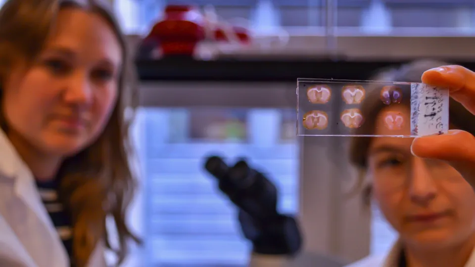 Glass slide with brain sections in front of two vague persons. Photo. 