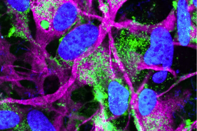 A photo from immunofluorescence staining showing alpha-synuclein aggregates in green close to astrocytes in purple.  