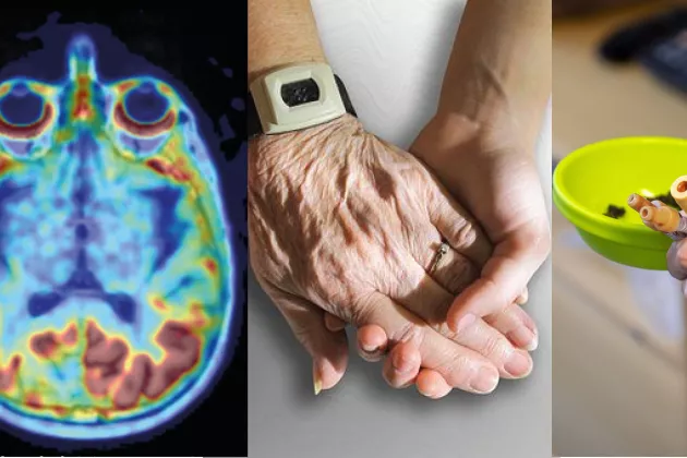 A photo collage showing brain imaging, two hands, and a blood sample. 