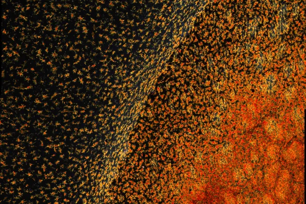 Microglia in rat brain. Photo. 