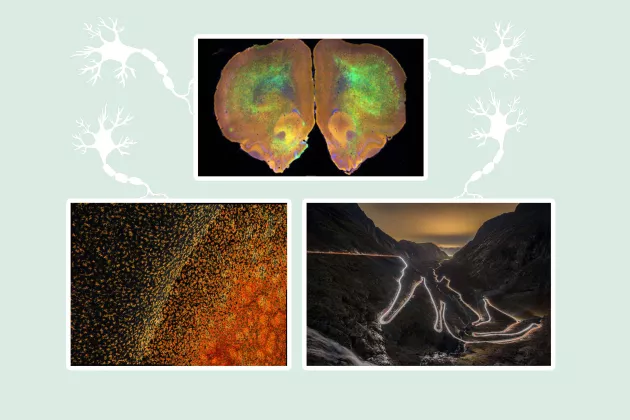 3 photos of brain section, microglia and nature. Collage. 
