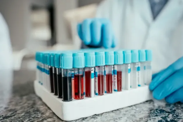 Tray of test tubes containing blood samples