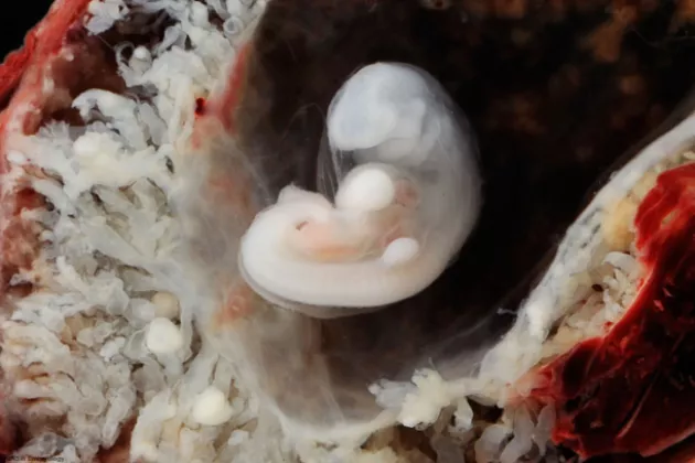 Human embryo. Photo