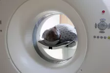 A patient inside a brain scan machine. Photo. 