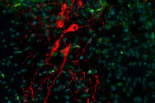 Neurons from the substantia Nigra pars compacta in red. Photo. 