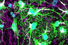 An image of co-cultures with neuronal projections in purple and astrocytes in green. Image. 