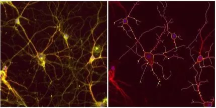 Primary mouse cortical neurons. Photo.