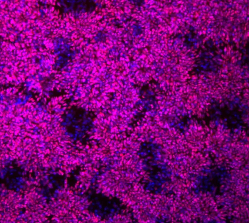 Picture from microscope on neural stem cells colored in pink. 