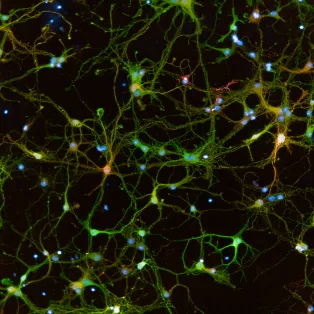 Photo of mouse e14 cortical neurons 