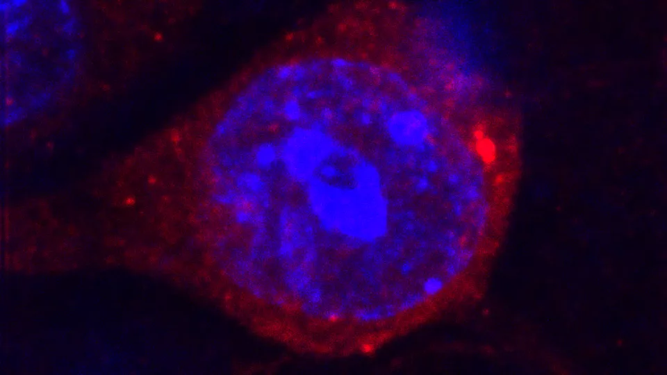 En förstorad bild av en nervcell (blå) som förlorat den epigenetiska kontrollen av ERV och därmed uttrycker virusrelaterade protein (röd). Foto: Marie Jönsson