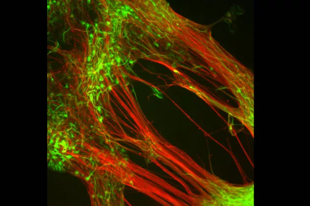 Dopaminproducerande nervceller som odlats fram i laboratorium från humana embryonala stamceller. Foto. 
