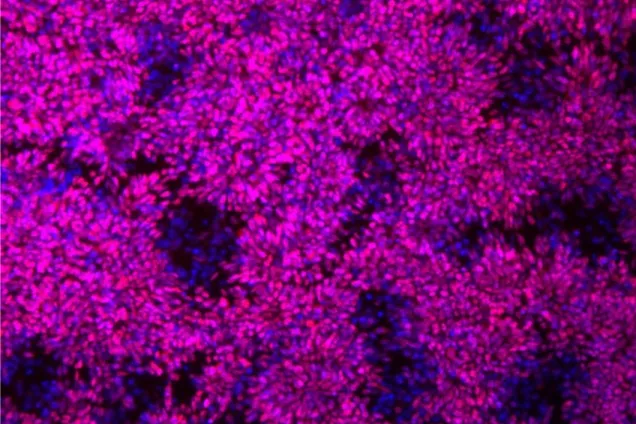 Mikroskopi-bild på neurala stamceller. 