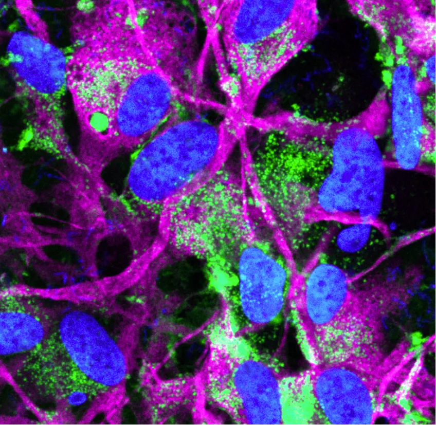 Fotografi på immunohistologisk färgning där alfa-synuklein syns i grönt nära astrocyterna i lila. 