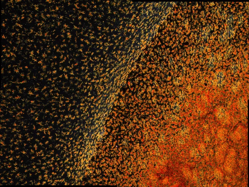 Bild på en råtthjärna och specifikt mikrogliaceller